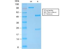 Image no. 5 for anti-Cadherin 1, Type 1, E-Cadherin (Epithelial) (CDH1) antibody (ABIN6941299)