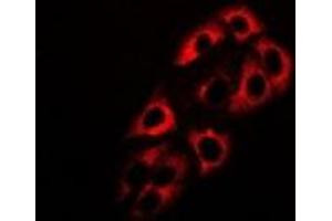Image no. 1 for anti-Alcohol Dehydrogenase 5 (Class III), chi Polypeptide (ADH5) antibody (ABIN3197864)