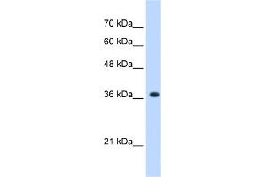 Image no. 1 for anti-alpha-1,4-N-Acetylglucosaminyltransferase (A4GNT) (C-Term) antibody (ABIN2782875)