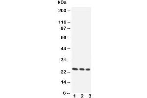 Image no. 1 for anti-Homeobox A6 (HOXA6) (Middle Region) antibody (ABIN3031250)