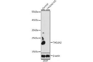 TAGLN2 antibody