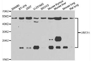 Image no. 2 for anti-Ubiquitin-Conjugating Enzyme E2H (UBE2H) antibody (ABIN6149801)