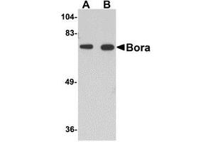 Image no. 2 for anti-Protein Aurora Borealis (BORA) (C-Term) antibody (ABIN499489)