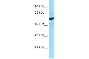 Image no. 1 for anti-Succinate-CoA Ligase, GDP-Forming, beta Subunit (SUCLG2) (C-Term) antibody (ABIN2790590)