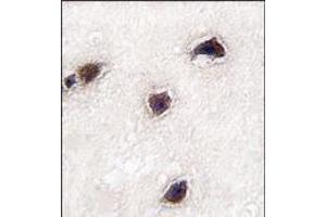Image no. 2 for anti-Calcium Binding Protein 1 (CABP1) (C-Term) antibody (ABIN359761)