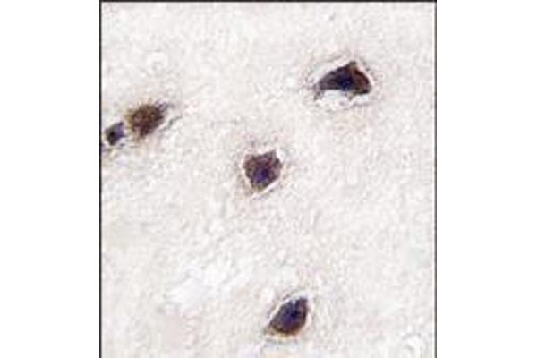 CABP1 antibody  (C-Term)