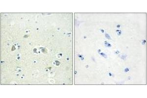 Image no. 2 for anti-Growth Arrest-Specific 6 (GAS6) (AA 291-340) antibody (ABIN1533886)