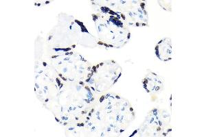 Immunohistochemistry of paraffin-embedded human placenta using RCC1 Rabbit mAb (ABIN1512845, ABIN3021028, ABIN3021029 and ABIN7101332) at dilution of 1:100 (40x lens).