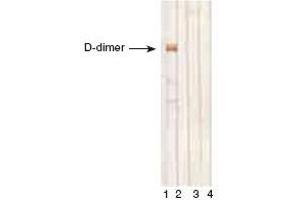 anti-D-Dimer antibody