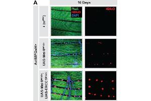 Systemic hormetic responses from muscle-specific DNA damage.