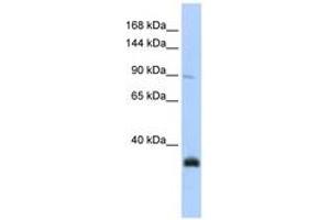 Image no. 1 for anti-MORC Family CW-Type Zinc Finger 3 (MORC3) (AA 180-229) antibody (ABIN6743396)