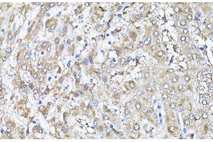 Immunohistochemistry of paraffin-embedded Human liver using Snail Polyclonal Antibody at dilution of 1:100 (40x lens).