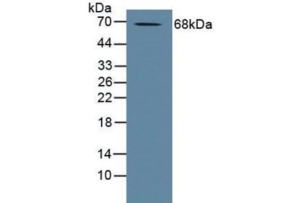 ADAM10 Antikörper  (AA 420-641)