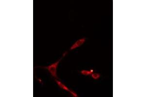 Image no. 1 for anti-Carbonic Anhydrase XIII (CA13) (Internal Region) antibody (ABIN6258658)