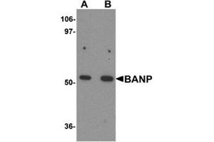 Image no. 1 for anti-Protein BANP (BANP) (Center) antibody (ABIN783725)