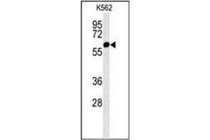 Image no. 4 for anti-Histone Deacetylase 2 (HDAC2) (AA 417-447), (Middle Region) antibody (ABIN952698)