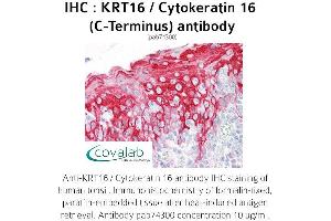 Image no. 1 for anti-Keratin 16 (KRT16) antibody (ABIN1736281)