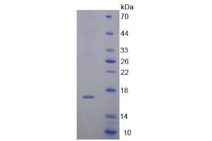 Image no. 1 for D-Dopachrome Tautomerase (DDT) (AA 2-118) protein (His tag) (ABIN6237008)