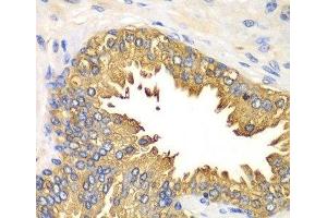 Immunohistochemistry of paraffin-embedded Human prostate using RIG-I / DDX58 Polyclonal Antibody at dilution of 1:100 (40x lens).