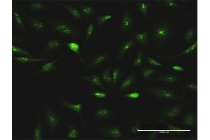 Image no. 2 for anti-ESF1, Nucleolar Pre-rRNA Processing Protein, Homolog (ESF1) (AA 1-851) antibody (ABIN949341)