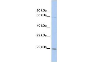 Image no. 1 for anti-Kruppel-Like Factor 3 (Basic) (KLF3) (C-Term) antibody (ABIN2779495)