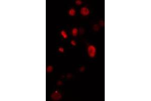 Image no. 2 for anti-Zinc Finger Protein 541 (ZNF541) (Internal Region) antibody (ABIN6257571)
