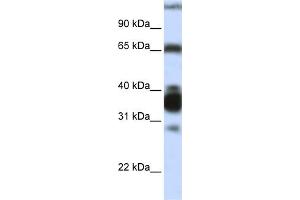 Image no. 3 for anti-Arginase, Liver (ARG1) (N-Term) antibody (ABIN2782309)