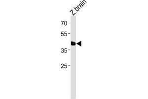 Image no. 1 for anti-Transcription Factor AP-2 epsilon (Activating Enhancer Binding Protein 2 Epsilon) (TFAP2E) antibody (ABIN3004620)