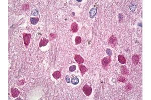 Image no. 2 for anti-Retinoblastoma-Like 2 (p130) (RBL2) (AA 878-913) antibody (ABIN1491690)