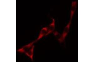 Image no. 1 for anti-KDEL (Lys-Asp-Glu-Leu) Endoplasmic Reticulum Protein Retention Receptor 3 (kDELR3) antibody (ABIN6256985)
