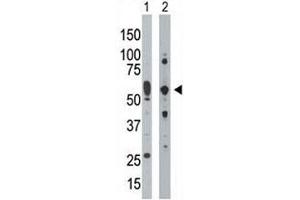 Image no. 4 for anti-Eukaryotic Translation Initiation Factor 2-alpha Kinase 2 (EIF2AK2) (AA 519-550) antibody (ABIN3030885)