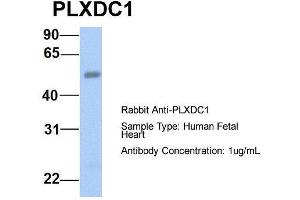 Image no. 2 for anti-Plexin Domain Containing 1 (PLXDC1) (N-Term) antibody (ABIN2783776)