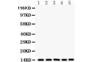 Image no. 4 for anti-Fatty Acid Binding Protein 1, Liver (FABP1) (AA 6-36), (N-Term) antibody (ABIN3042384)