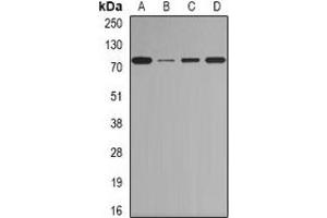 Image no. 2 for anti-CCCTC-Binding Factor (Zinc Finger Protein)-Like (CTCFL) antibody (ABIN2966473)