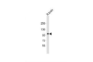 Image no. 3 for anti-Zinc Finger Protein 387 (ZNF387) (AA 339-367), (N-Term) antibody (ABIN651571)