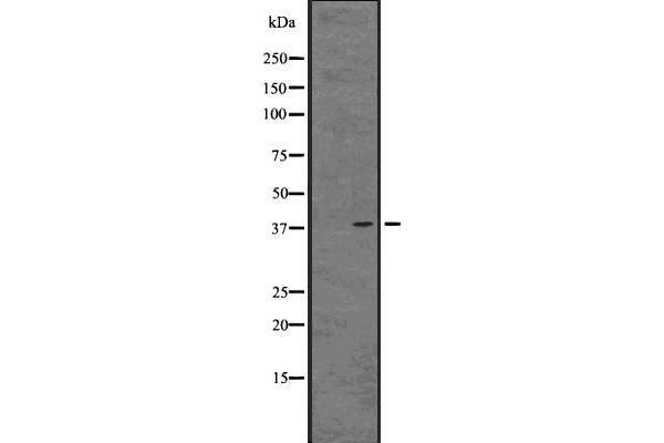 anti-G Protein-Coupled Receptor 81 (GPR81) (C-Term) antibody