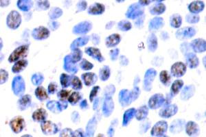 Image no. 2 for anti-Jun B Proto-Oncogene (JUNB) antibody (ABIN265489)