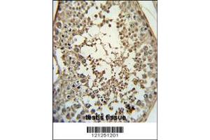 Image no. 2 for anti-Pro-Melanin-Concentrating Hormone (PMCH) (AA 94-122) antibody (ABIN651719)