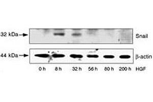 Image no. 5 for anti-SNAIL (SNAI1) (AA 9-39) antibody (ABIN3032657)