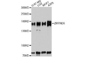 Image no. 1 for anti-Zinc Finger, MYND-Type Containing 8 (ZMYND8) antibody (ABIN6150459)