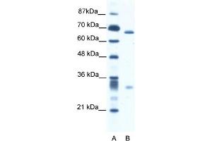 Image no. 1 for anti-Set1/Ash2 Histone Methyltransferase Complex Subunit ASH2 (ASH2L) (N-Term) antibody (ABIN2778327)