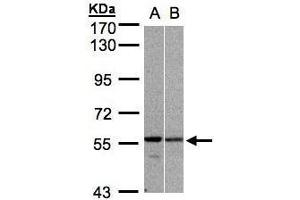 Image no. 1 for anti-Pre-mRNA Processing Factor 19 (PRPF19) (Center) antibody (ABIN2856464)