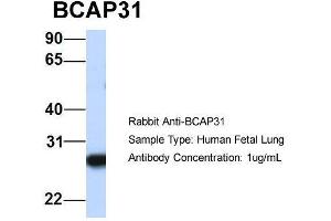 Image no. 2 for anti-B-Cell Receptor-Associated Protein 31 (BCAP31) (Middle Region) antibody (ABIN2782693)