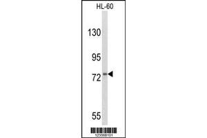 Western Blotting (WB) image for anti-Colony Stimulating Factor 3 Receptor (Granulocyte) (CSF3R) antibody (ABIN2158382)