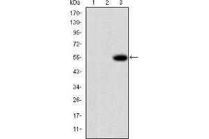 Image no. 6 for anti-Matrix Metallopeptidase 9 (Gelatinase B, 92kDa Gelatinase, 92kDa Type IV Collagenase) (MMP9) antibody (ABIN969288)