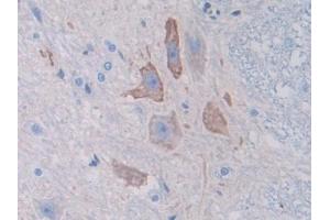 Image no. 2 for anti-Spectrin alpha Chain, Brain (SPTAN1) (AA 1571-1712) antibody (ABIN1860636)