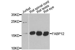 Image no. 1 for anti-Fatty Acid Binding Protein 12 (FABP12) antibody (ABIN3068851)