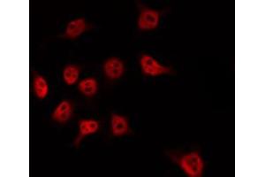 Image no. 2 for anti-Mediator Complex Subunit 17 (MED17) antibody (ABIN6257836)