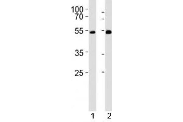 LCK Antikörper  (AA 23-52)