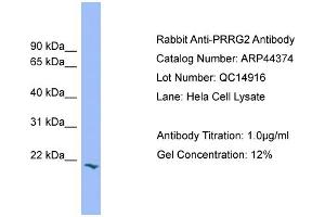 Image no. 1 for anti-Proline-Rich Gla (G-Carboxyglutamic Acid) Polypeptide 2 (PRRG2) (Middle Region) antibody (ABIN2781838)